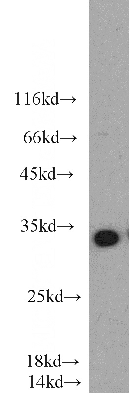 Jurkat cells were subjected to SDS PAGE followed by western blot with Catalog No:109667(CCNG1 antibody) at dilution of 1:1000