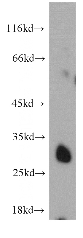mouse liver tissue were subjected to SDS PAGE followed by western blot with Catalog No:115321(SLC25A10 antibody) at dilution of 1:500