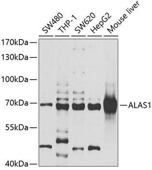 Western blot - ALAS1 Polyclonal Antibody 