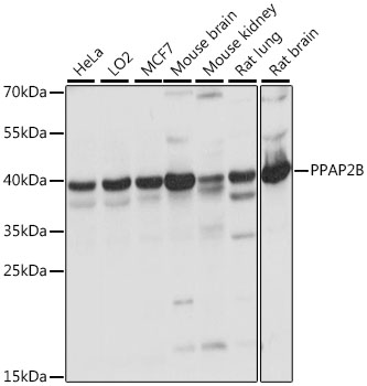 Western blot - PPAP2B Polyclonal Antibody 