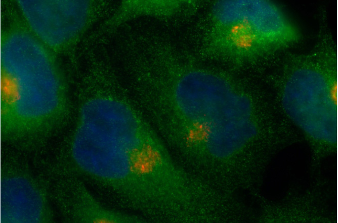 IF result of ARF6 antibody (Catalog No:108249, 1:100) with PFA fixed HeLa cells. Green: ARF6 antibody stains PM and recycling endosomes. Red: Golgi stain.