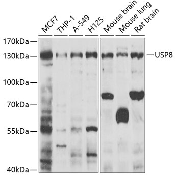 Western blot - USP8 Polyclonal Antibody 