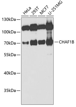 Western blot - CHAF1B Polyclonal Antibody 