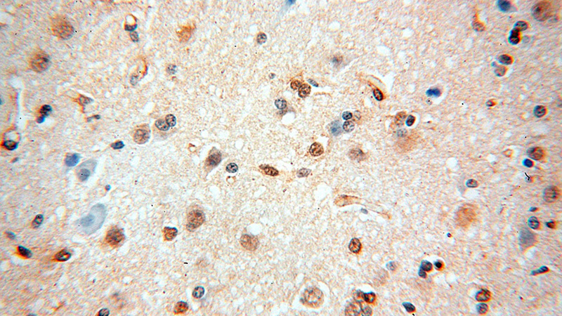 Immunohistochemical of paraffin-embedded human brain using Catalog No:111479(HMGB2 antibody) at dilution of 1:100 (under 40x lens)