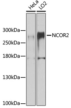 Western blot - NCOR2 Polyclonal Antibody 