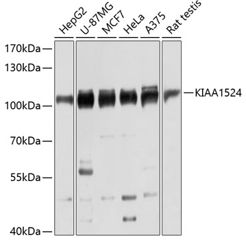 Western blot - KIAA1524 Polyclonal Antibody 