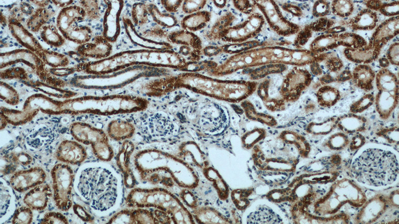 Immunohistochemical of paraffin-embedded human kidney using Catalog No:116577(UMOD antibody) at dilution of 1:50 (under 10x lens)