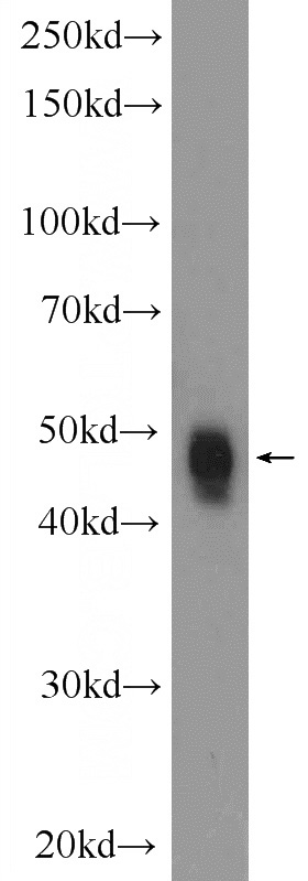K-562 cells were subjected to SDS PAGE followed by western blot with Catalog No:115421(SMAD5 Antibody) at dilution of 1:1000