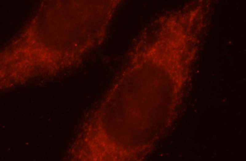 Immunofluorescent analysis of MCF-7 cells, using AKAP1 antibody Catalog No:107927 at 1:25 dilution and Rhodamine-labeled goat anti-rabbit IgG (red).