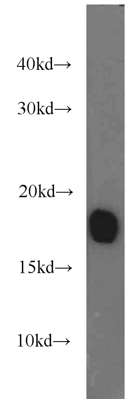mouse skeletal muscle tissue were subjected to SDS PAGE followed by western blot with Catalog No:112992(MB antibody) at dilution of 1:1000
