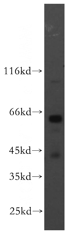 human brain tissue were subjected to SDS PAGE followed by western blot with Catalog No:113899(PIGZ antibody) at dilution of 1:500