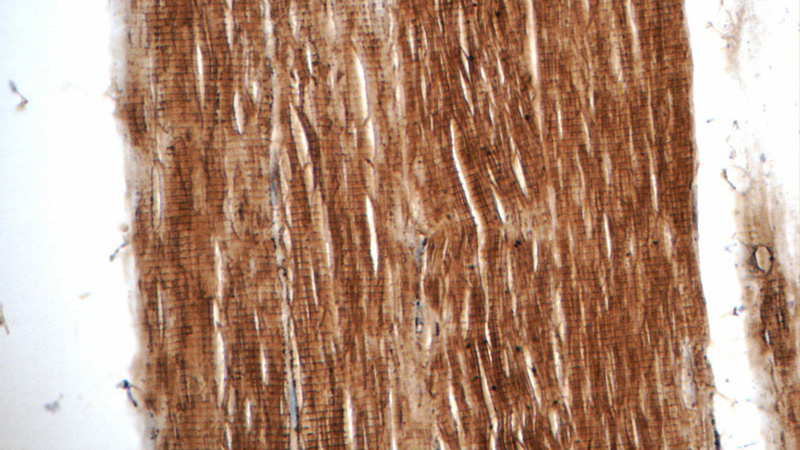 Immunohistochemistry of paraffin-embedded human skeletal muscle tissue slide using Catalog No:109366(CFL2 Antibody) at dilution of 1:50 (under 40x lens)