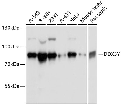 Western blot - DDX3Y Polyclonal Antibody 