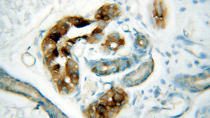 Immunohistochemical of paraffin-embedded human skin using Catalog No:110900(GCDFP-15, PIP antibody) at dilution of 1:50 (under 40x lens)