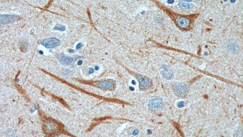 Immunohistochemistry of paraffin-embedded human brain tissue slide using Catalog No:107332(NEFL Antibody) at dilution of 1:200 (under 40x lens).
