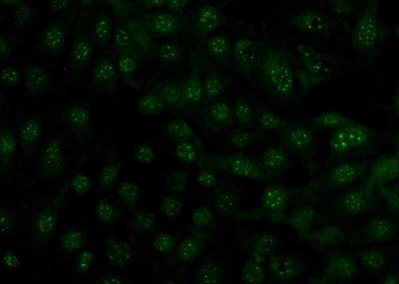 Immunofluorescent analysis of (-20oc Ethanol) fixed SH-SY5Y cells using Catalog No:110888(GBA Antibody) at dilution of 1:100 and Alexa Fluor 488-congugated AffiniPure Goat Anti-Rabbit IgG(H+L)