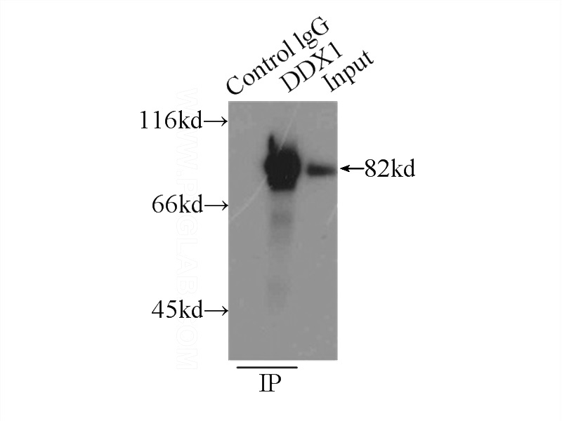 IP Result of anti-DDX1 (IP:Catalog No:109779, 3ug; Detection:Catalog No:109779 1:1000) with PC-3 cells lysate 5000ug.