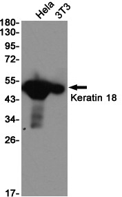 Western blot detection of Keratin 18 in Hela,3T3 cell lysates using Keratin 18 (2D6) Mouse mAb(1:1000 diluted).Predicted band size:46KDa.Observed band size:46KDa.