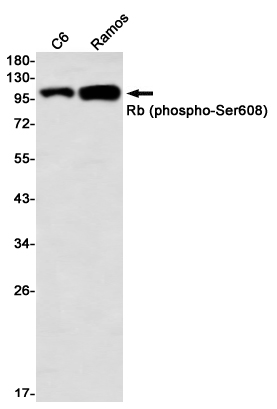 Western blot detection of Rb (phospho-Ser608) in C6,Ramos using Rb (phospho-Ser608) Rabbit mAb(1:1000 diluted)