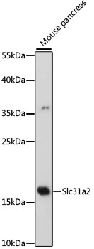 Western blot - Slc31a2 Polyclonal Antibody 