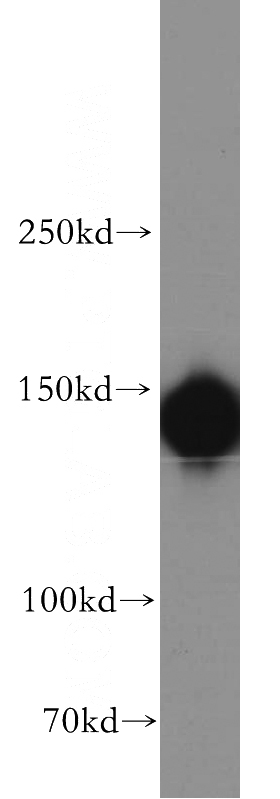 HeLa cells were subjected to SDS PAGE followed by western blot with Catalog No:109937(DIAP1 antibody) at dilution of 1:500