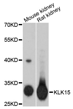 Western blot - KLK15 Polyclonal Antibody 