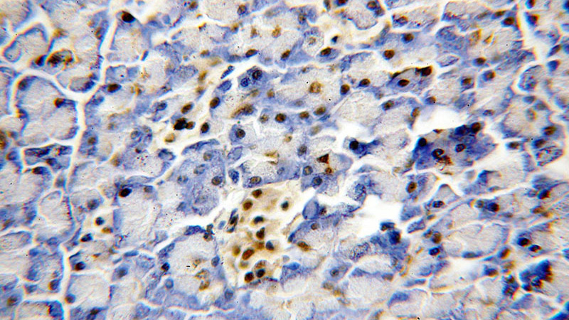 Immunohistochemical of paraffin-embedded human pancreas using Catalog No:109781(DDX17,P72 antibody) at dilution of 1:100 (under 40x lens)