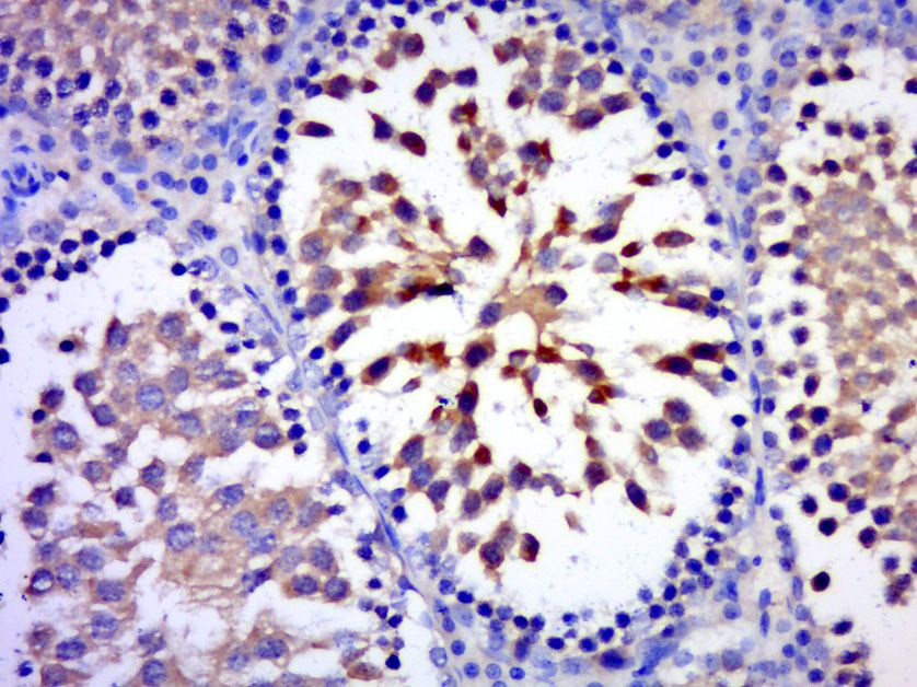 Fig1: Paraformaldehyde-fixed, paraffin embedded (rat testis); Antigen retrieval by boiling in sodium citrate buffer (pH6.0) for 15min; Block endogenous peroxidase by 3% hydrogen peroxide for 20 minutes; Blocking buffer (normal goat serum) at 37℃ for 30min; Antibody incubation with (C17orf75) Polyclonal Antibody, Unconjugated at 1:400 overnight at 4℃, followed by a conjugated secondary (sp-0023) for 20 minutes and DAB staining.