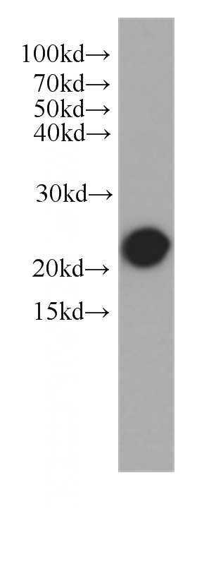 Jurkat cells were subjected to SDS PAGE followed by western blot with Catalog No:107129(CD3E antibody) at dilution of 1:1000