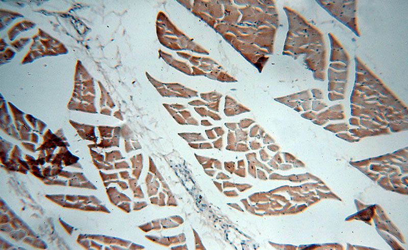 Immunohistochemical of paraffin-embedded human skeletal muscle using Catalog No:116705(VAMP2 antibody) at dilution of 1:50 (under 10x lens)