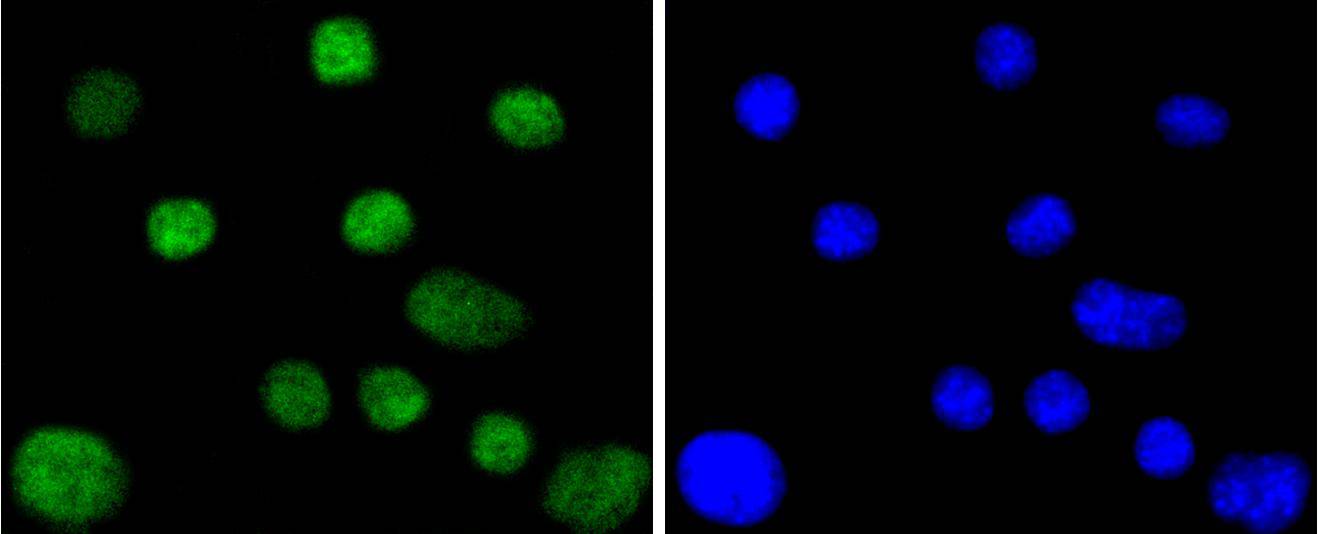 Fig4: ICC staining CDC40 in SHG-44 cells (green). The nuclear counter stain is DAPI (blue). Cells were fixed in paraformaldehyde, permeabilised with 0.25% Triton X100/PBS.
