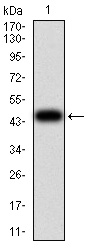 Fig1: Western blot analysis of TBCC on human TBCC recombinant protein using anti-TBCC antibody at 1/1,000 dilution.
