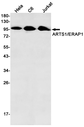 Western blot detection of ARTS1/ERAP1 in Hela,C6,Jurkat cell lysates using ARTS1/ERAP1 Rabbit mAb(1:500 diluted).Predicted band size:107kDa.Observed band size:107kDa.