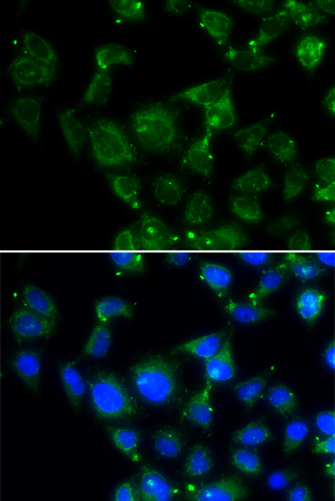 Immunofluorescence - MAPRE2 Polyclonal Antibody 