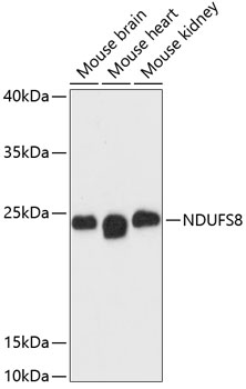 Western blot - NDUFS8 Polyclonal Antibody 