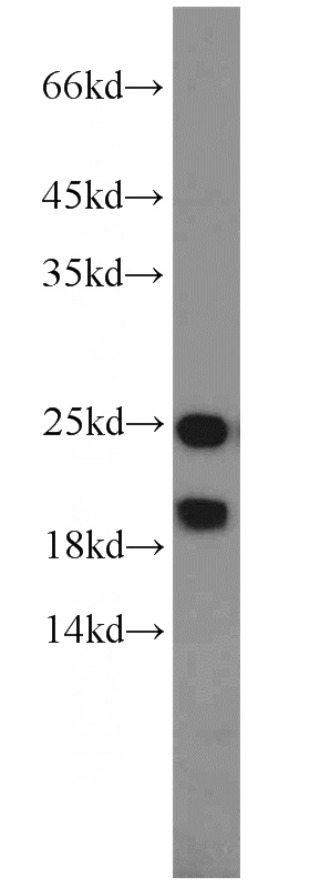 HeLa cells were subjected to SDS PAGE followed by western blot with Catalog No:113584(PARK7,DJ-1 antibody) at dilution of 1:1000
