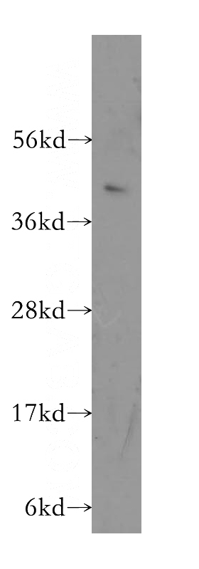 K-562 cells were subjected to SDS PAGE followed by western blot with Catalog No:112866(MS4A7 antibody) at dilution of 1:400