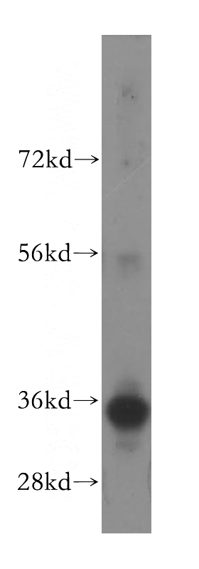 human liver tissue were subjected to SDS PAGE followed by western blot with Catalog No:110569(FCN1 antibody) at dilution of 1:500