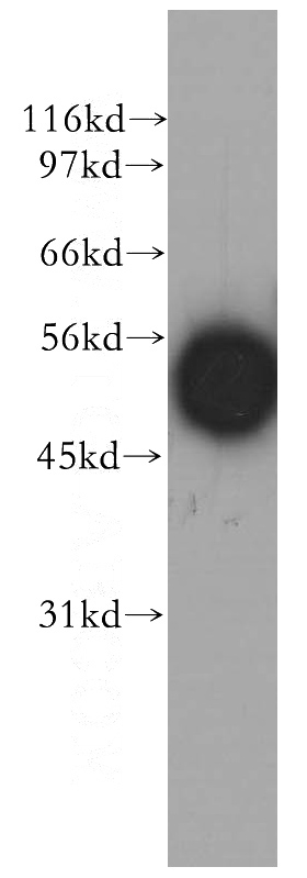 human lung tissue were subjected to SDS PAGE followed by western blot with Catalog No:110305(EDIL3 antibody) at dilution of 1:400