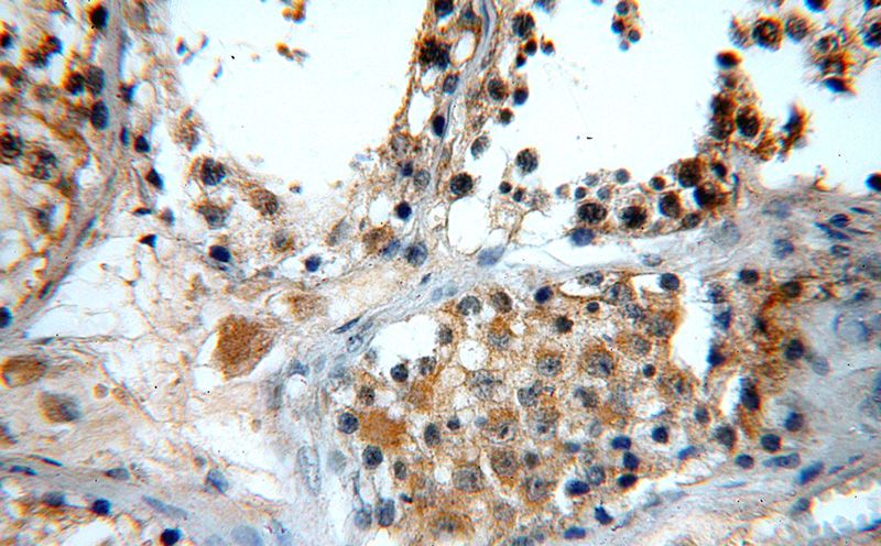 Immunohistochemical of paraffin-embedded human testis using Catalog No:111245(GTPBP5 antibody) at dilution of 1:100 (under 40x lens)