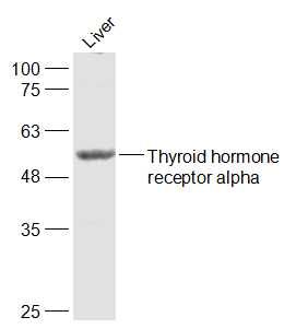 Fig2: Sample:; Liver (Mouse) Lysate at 40 ug; Primary: Anti-Thyroid hormone receptor alpha at 1/1000 dilution; Secondary: IRDye800CW Goat Anti-Rabbit IgG at 1/20000 dilution; Predicted band size: 55 kD; Observed band size: 55 kD