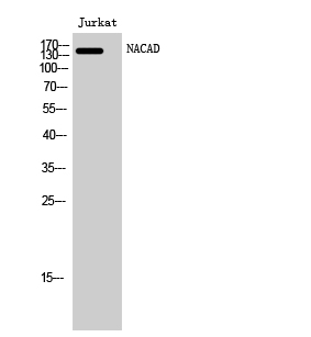 Fig1:; Western Blot analysis of Jurkat cells using NACAD Polyclonal Antibody