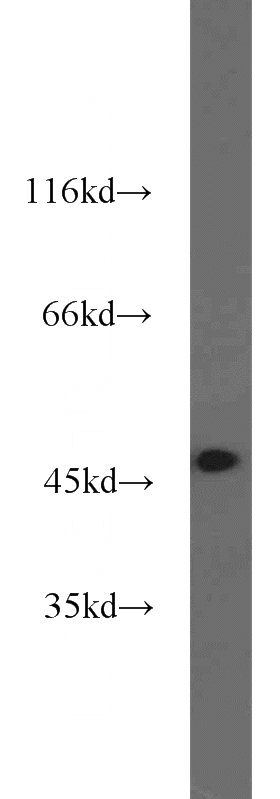 HeLa cells were subjected to SDS PAGE followed by western blot with Catalog No:108880(CASP9 antibody) at dilution of 1:1000