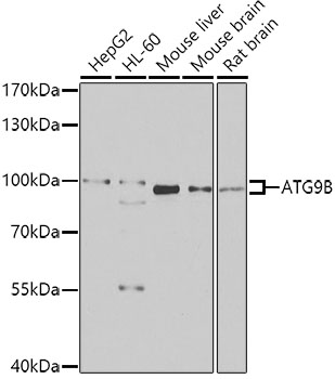 Western blot - ATG9B Polyclonal Antibody 