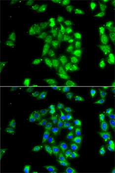 Immunofluorescence - ANTXR1 Polyclonal Antibody 