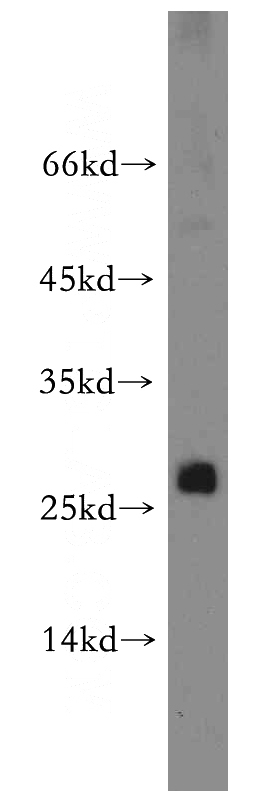 HeLa cells were subjected to SDS PAGE followed by western blot with Catalog No:114335(PTTG1IP antibody) at dilution of 1:200