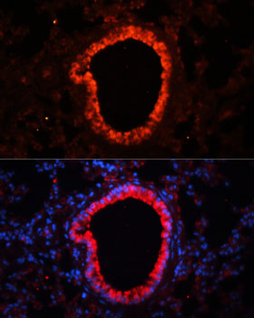 Immunofluorescence - NLRC4 Polyclonal Antibody 