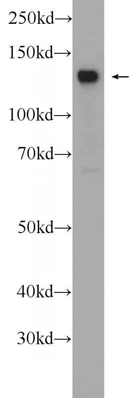 Jurkat cells were subjected to SDS PAGE followed by western blot with Catalog No:109223(CHERP Antibody) at dilution of 1:1000