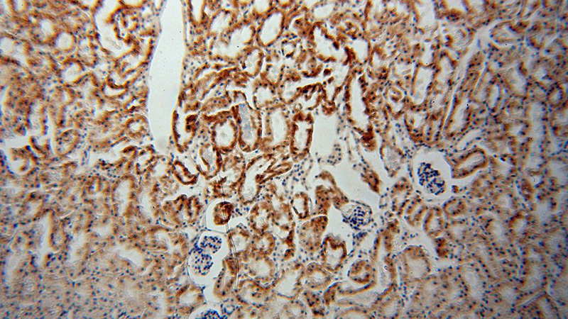 Immunohistochemical of paraffin-embedded human kidney using Catalog No:107713(ACOT9 antibody) at dilution of 1:100 (under 10x lens)