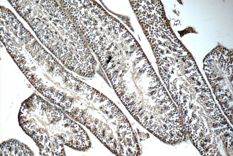 Immunohistochemistry of paraffin-embedded mouse testis tissue slide using Catalog No:115961(TEX264 Antibody) at dilution of 1:50 (under 10x lens)